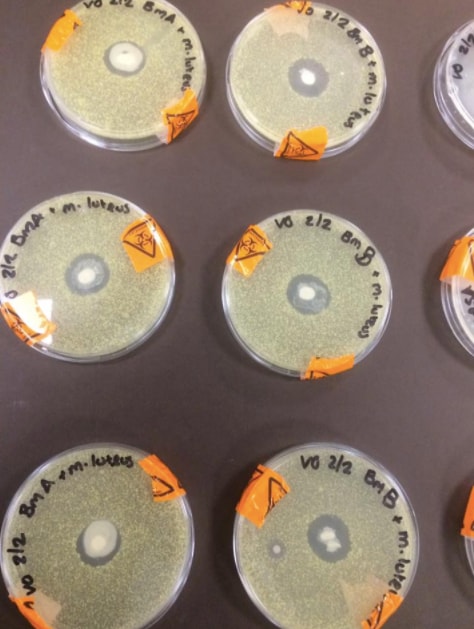 Here’s the Science Behind Those Viral Breast Milk Petri Dish Photos