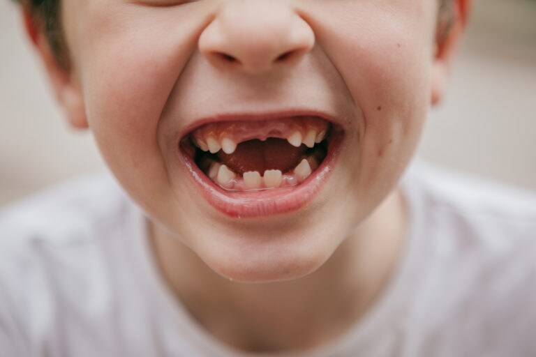 When do baby teeth fall out and in what order?
