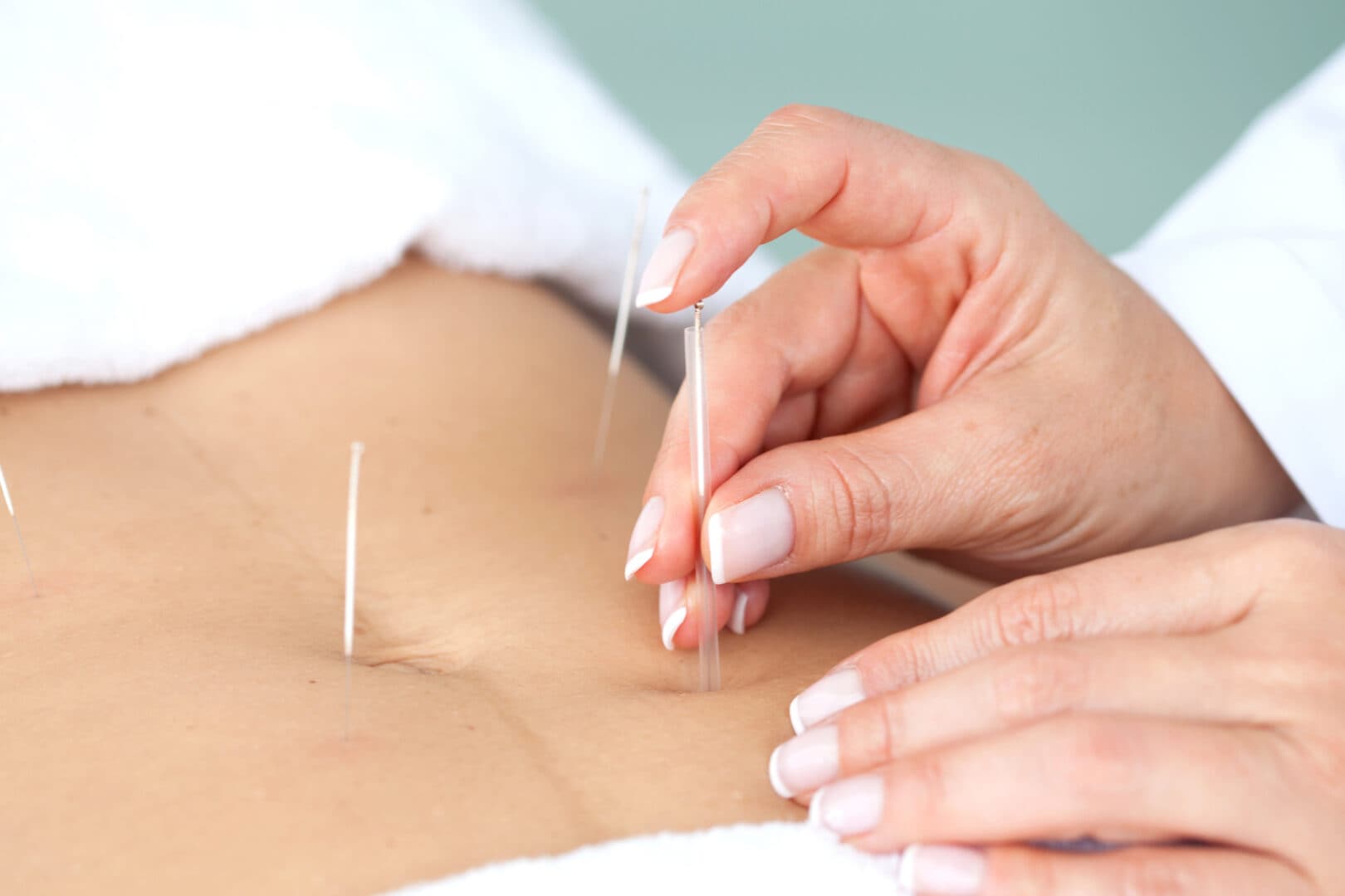 Acupuncture for fertility: What to know if you’re trying to conceive